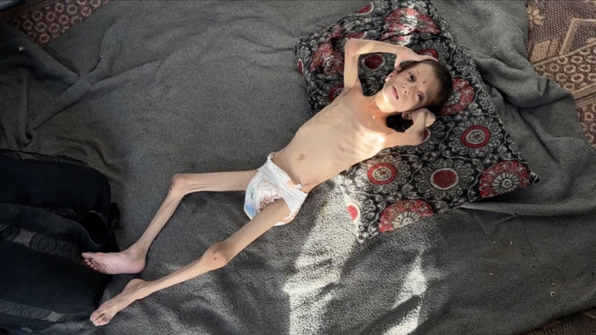 israilin kitliga surukledigi 10 yasindaki nafiz kemik yiginina donustu rMVr6vJ5