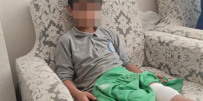 okul yolunda basibos kopegin saldirisina ugradi z9U3JBxm.jpg