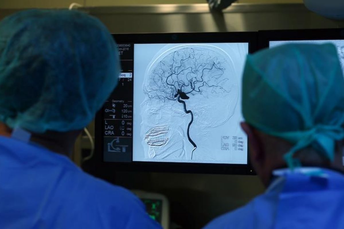 turk beyin damar hastaliklari dernegi turkiyede her yil yaklasik 100 bin kisi inme geciriyor NXkYA6Qp.jpg